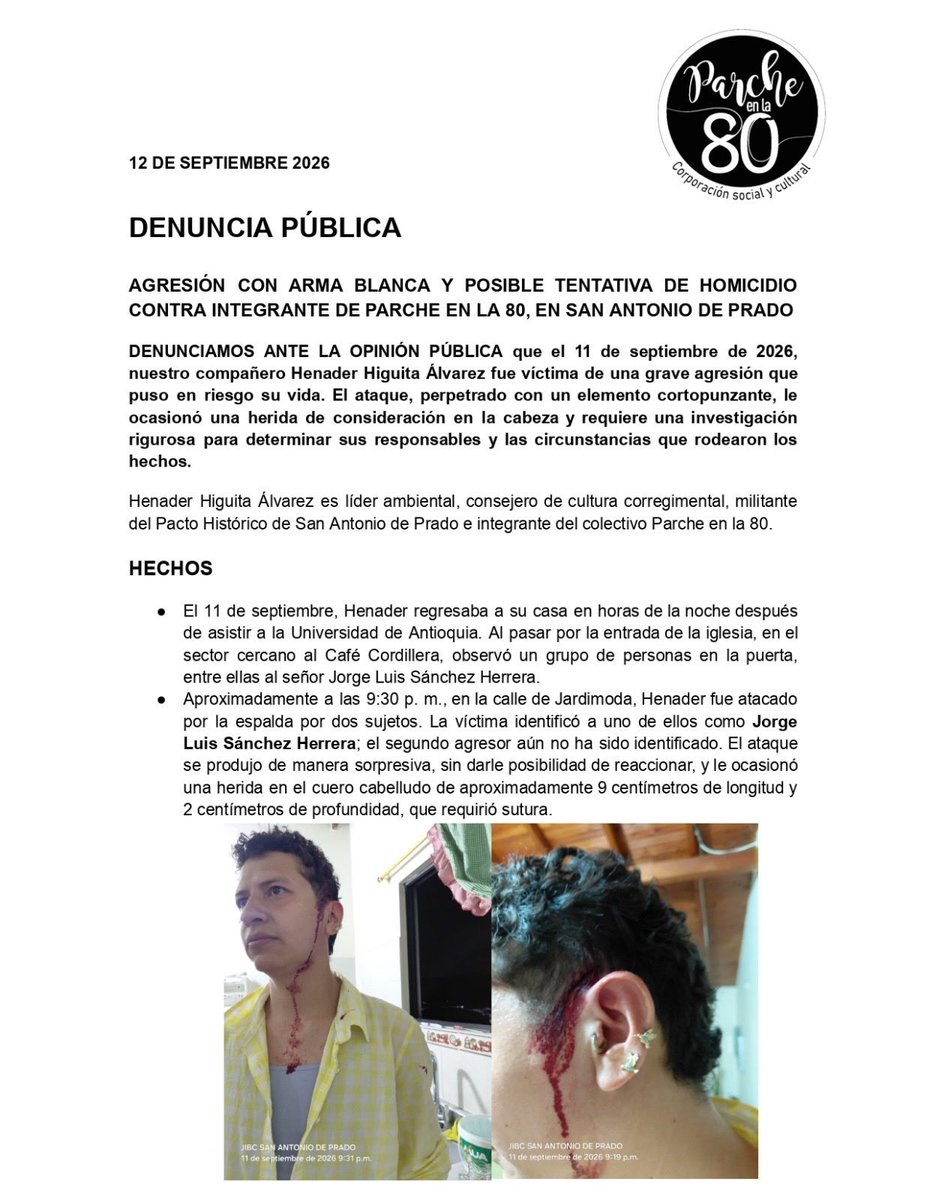 AquinoTicias1's tweet photo. Denuncia de agresión con arma cortopunzante a un compañero del @PactoCol en el Corregimiento de San Antonio de Prado en Medellín.

Los hechos denunciados son muy graves y deben ser investigados con celeridad @FiscaliaCol 

Solidaridad con el compañero Henader Álvarez. https://t.co/ur1GP4FXW2