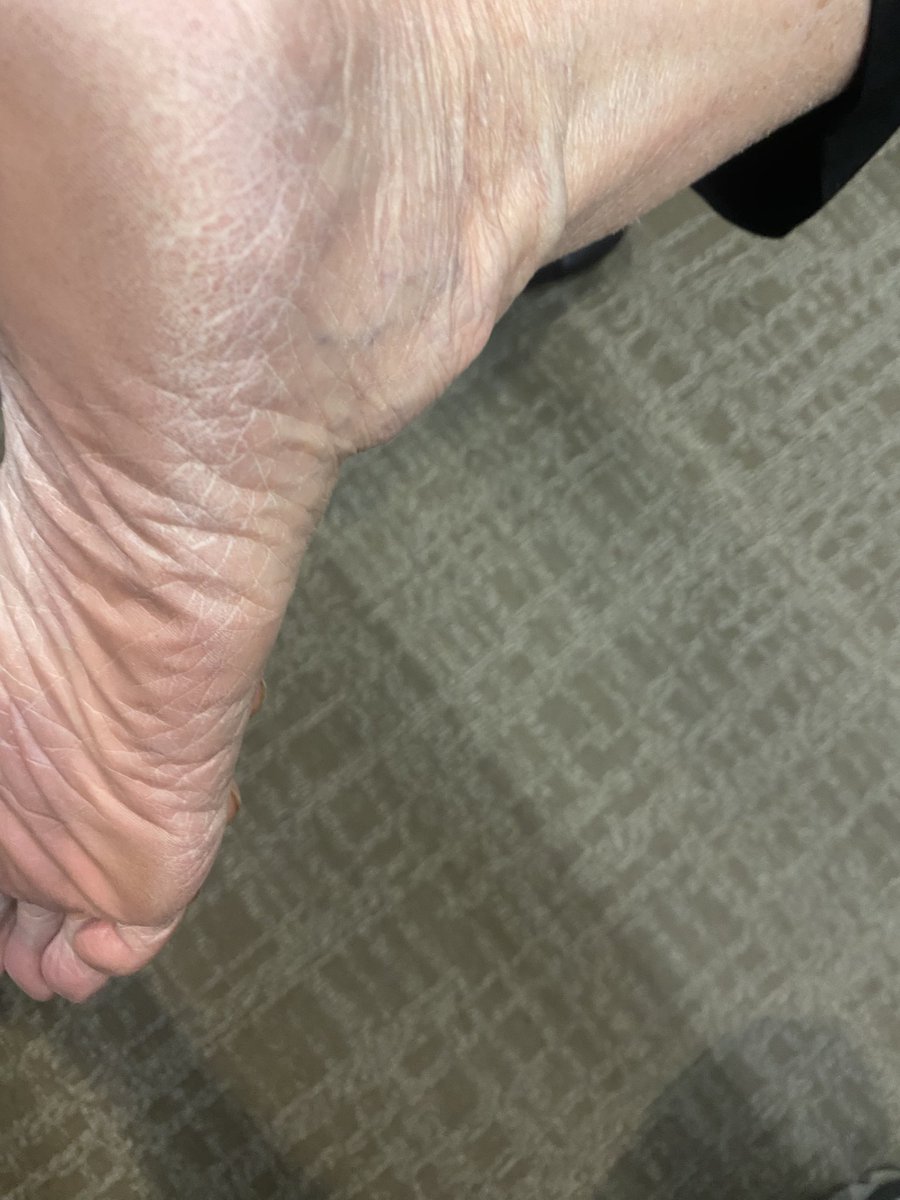 iLikeMilfFeet's tweet photo. White GILF soles Size 10 https://t.co/gL4c0j9Pdj
