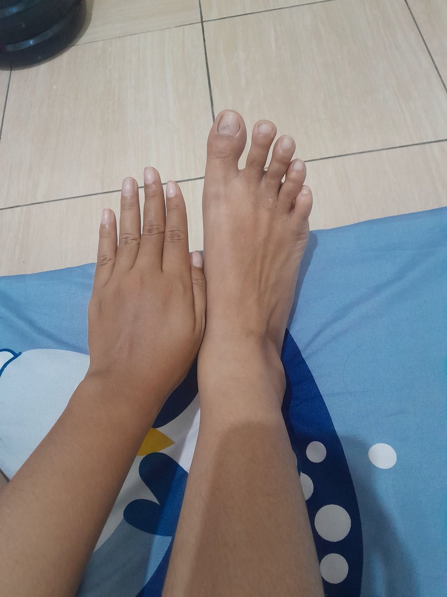 yourgirll_7's tweet photo. Buat yang kaki/tangannya belang dan kusam, ini worth dicoba banget. asal rutin, jangan baru 2x pake udah nuntut hasil 😭🤍
Real testi dari aku guys✨️

https://t.co/JhVihUTFLx https://t.co/zh9C3UBvNc