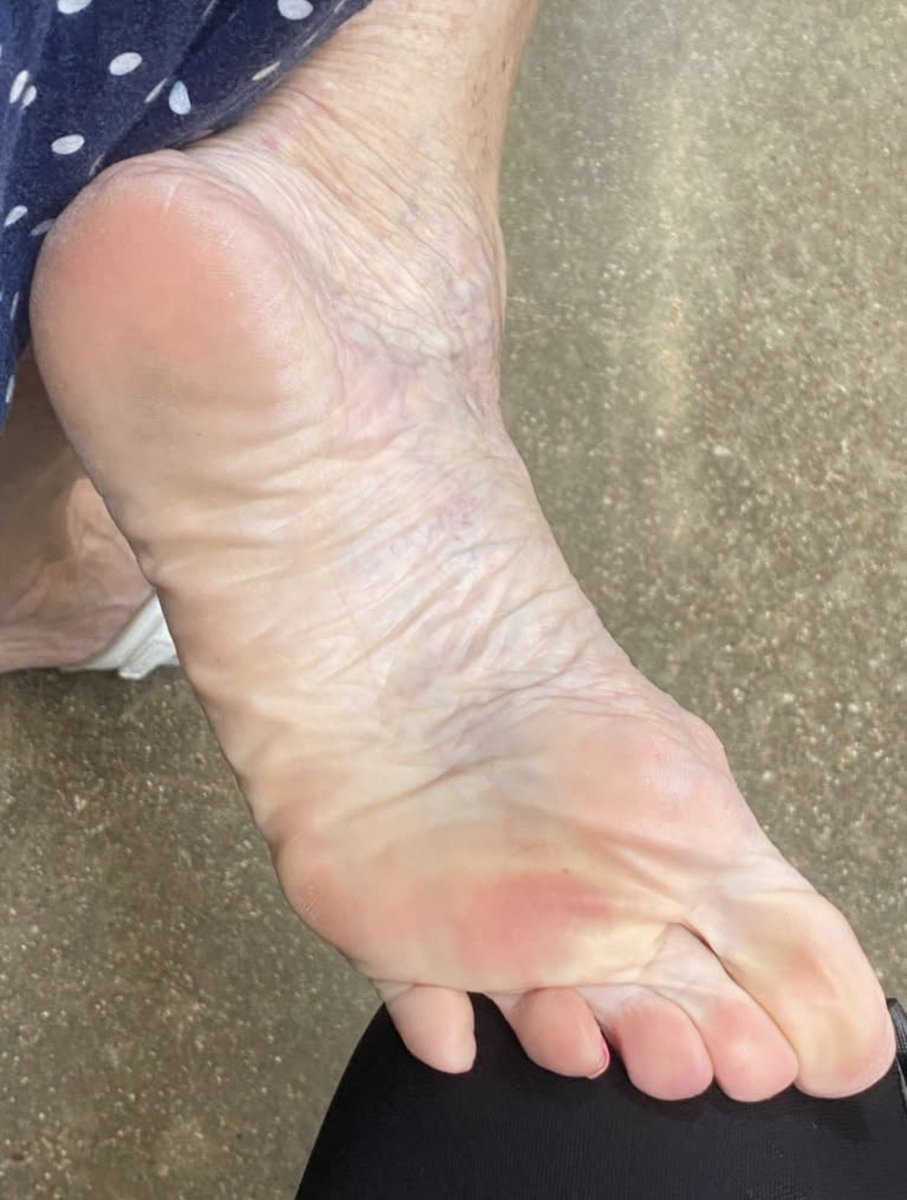 iLikeMilfFeet's tweet photo. White MILF feet Size 8.5 https://t.co/TWrG03mB1k
