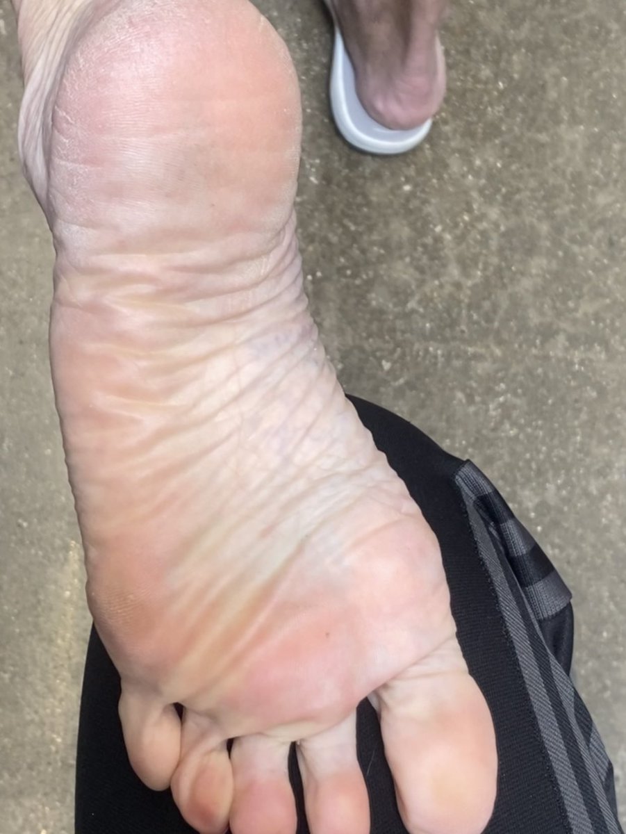 iLikeMilfFeet's tweet photo. White MILF feet Size 8.5 https://t.co/TWrG03mB1k