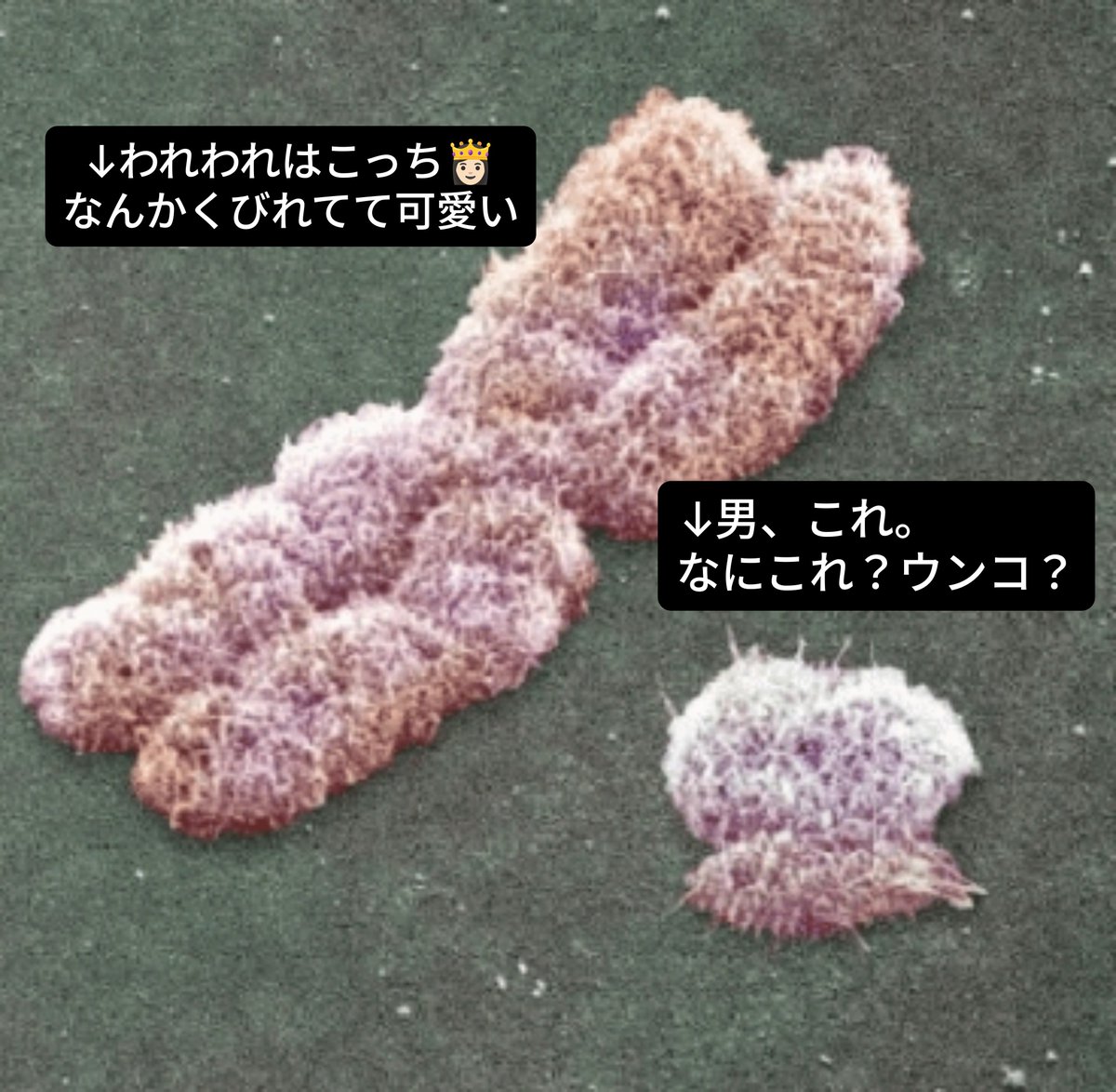 nanase2958's tweet photo. わかるわけ無いじゃん、。
こんな染色体の人に。。。
無理、���なくていいよ。 https://t.co/CHZulKp4AE