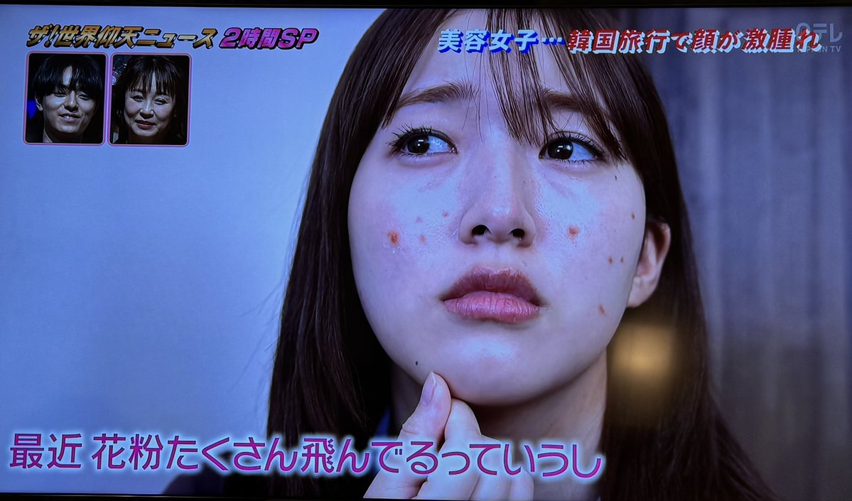 hajimerun0517's tweet photo. ニキビが気になって薬を購入していい感じに

#仰天ニュース
#田島芽瑠 https://t.co/VSVZ7cdX5S