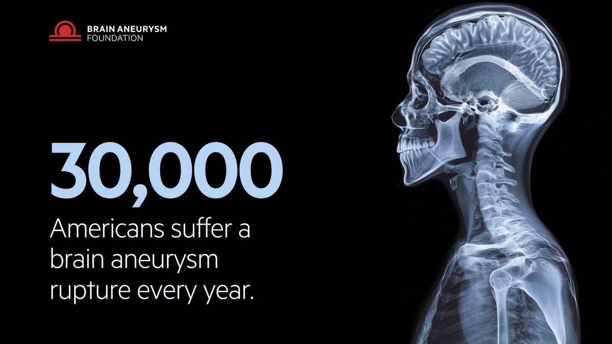 BAFOUND's tweet photo. 30,000 Americans suffer a brain aneurysm rupture every year. Awareness and early detection can change these odds. Know the warning signs, and share this with someone you love. Know the signs:  https://t.co/j9IRssEy8k https://t.co/ELnsIu8AHg