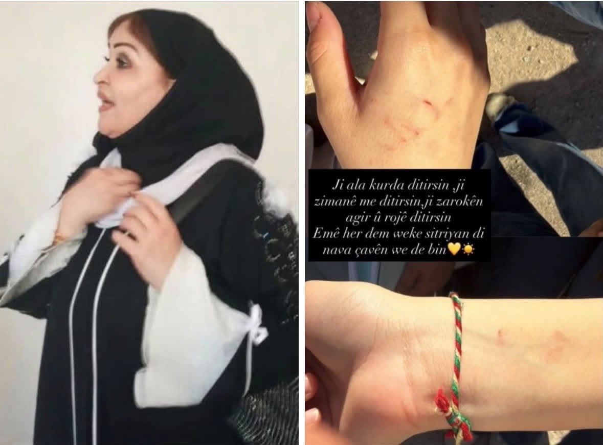 rukenturhalli1's tweet photo. HTŞ rejimi Rojava’ya Arap ırkçısı öğretmen atadı

HTŞ rejiminin Rojava’daki Kürt okullarına atadığı Arap milliyetçisi öğretmen Fawza Faysal’ın, Abdul Rahman al-Kawakibi Okulu’nda Kürdistan bayrağı renklerini taşıyan bileklik taktığı için Kürt öğrenciye şidet uyguladığı bildirildi https://t.co/iiC3l6K4eQ