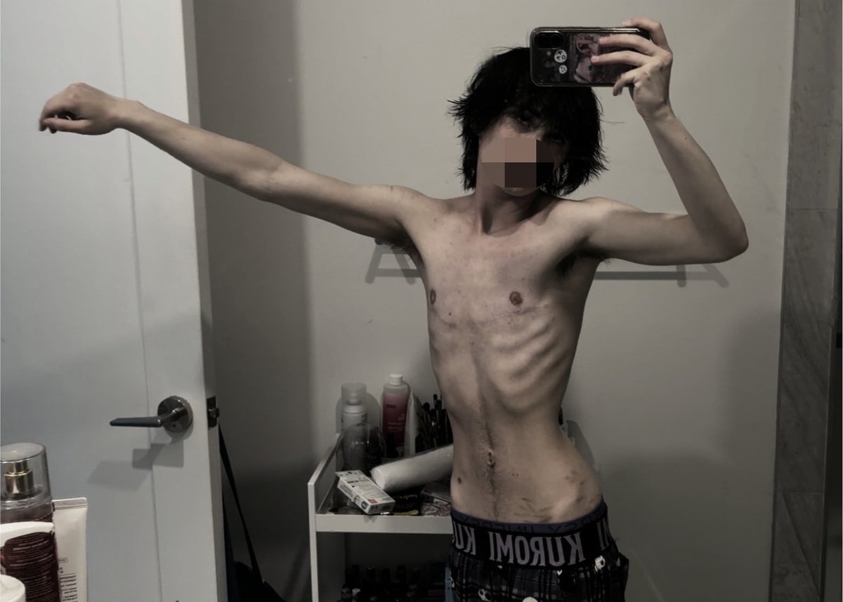 freakcreature__'s tweet photo. this guys bcs are my favorite thinspo ever but i completely lost his account 😭😭 https://t.co/mYil61Ywu1