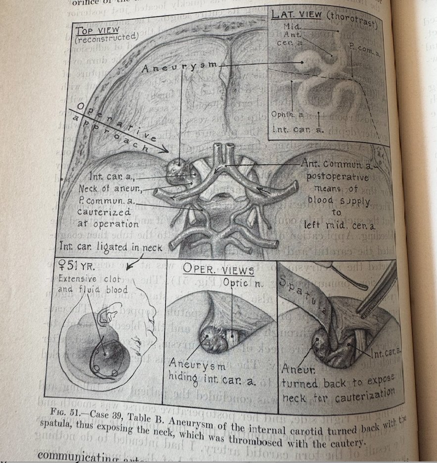 mtlawton's tweet photo. This private collection of books by Harvey Cushing is a loud declaration of this neurosurgeon’s genius & pioneering achievements, but it also reminds me of this lesson: if you want to make your mark on the field, putting in the effort to write books is a powerful way to develop your message & make it known. “The pen is mightier than the scalpel.” #SevenSeries