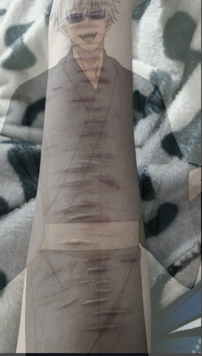 Asamitaka107's tweet photo. My scar looks so ugly i can never be scarspo💔( IK MY HAND IS SO FUCKING FAT) https://t.co/5YXpFPrxtV