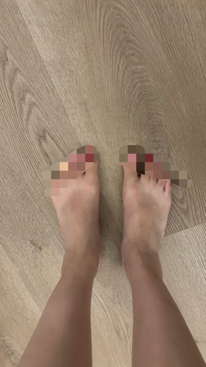 Vvdbug's tweet photo. 现在最担心的事情是遇到足控啊 穿着人字拖在欧洲暴走12天之后我的玉足变成了雷霆大黑脚 人字拖晒痕好像黑人穿了白色丁字裤 crush舔足的话只能舔到我大拇哥的茧子🥲 https://t.co/6yAMsu7gyZ