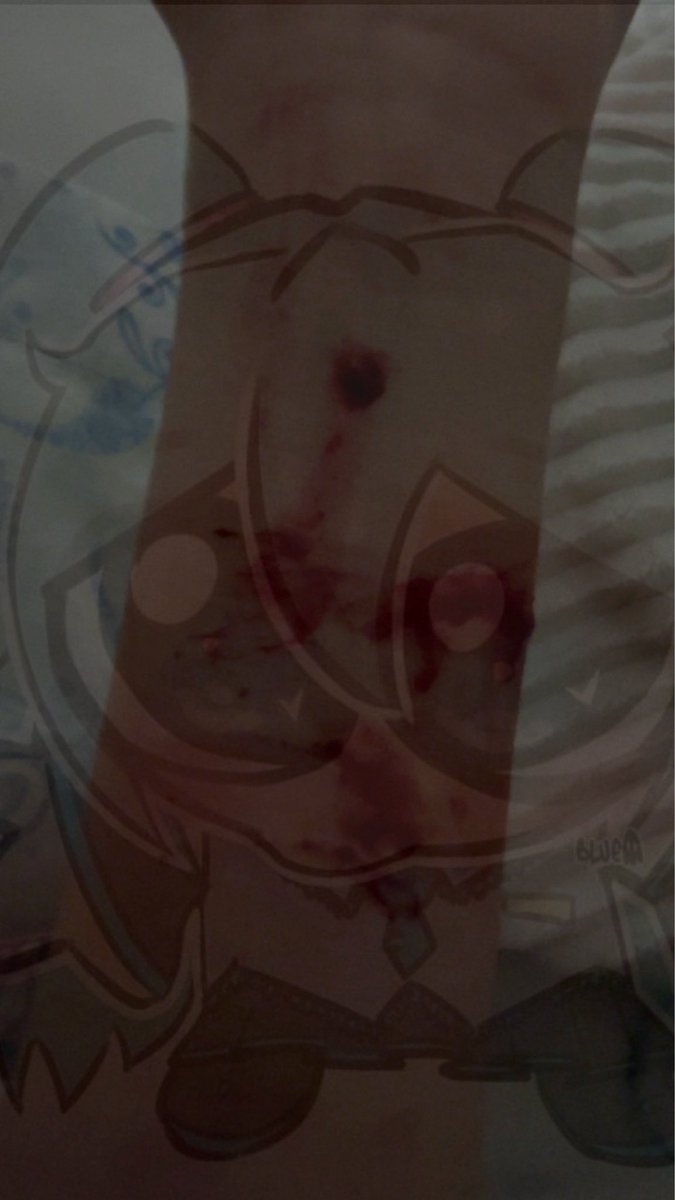 itschassx's tweet photo. Blood fake #shwt #sh https://t.co/ksgizK7iZl