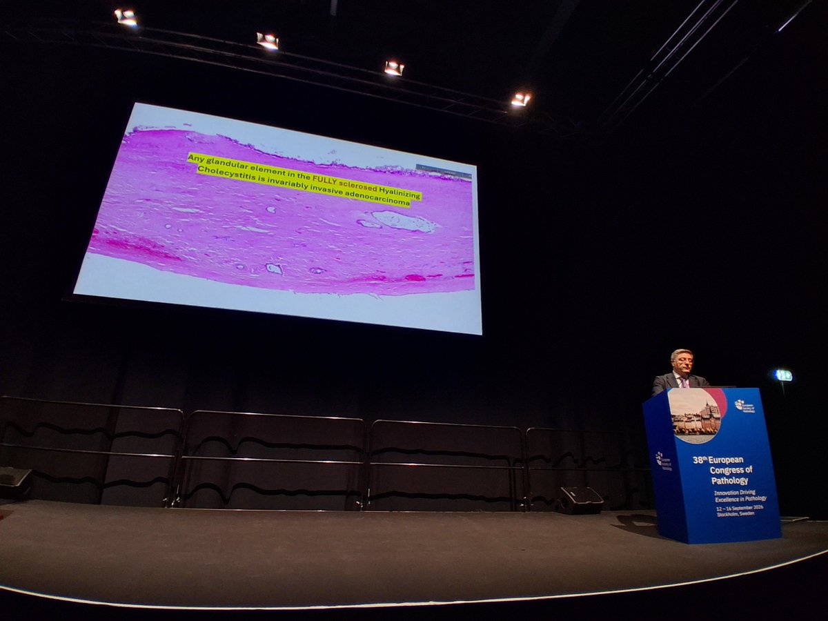 Chris_PouliosMD's tweet photo. The horror....
Clinging tumour cell groups, spots of high grade atypia in routine gallbladder resections....
To say 'easy to miss' is an understatememt.  
Videomicroscopy by Prof. Adsay at #ESPCongress https://t.co/7YBS5aolR5