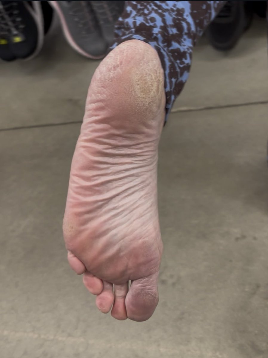 iLikeMilfFeet's tweet photo. White #MILF #soles Size 8.5 https://t.co/0qlYnWkp5v