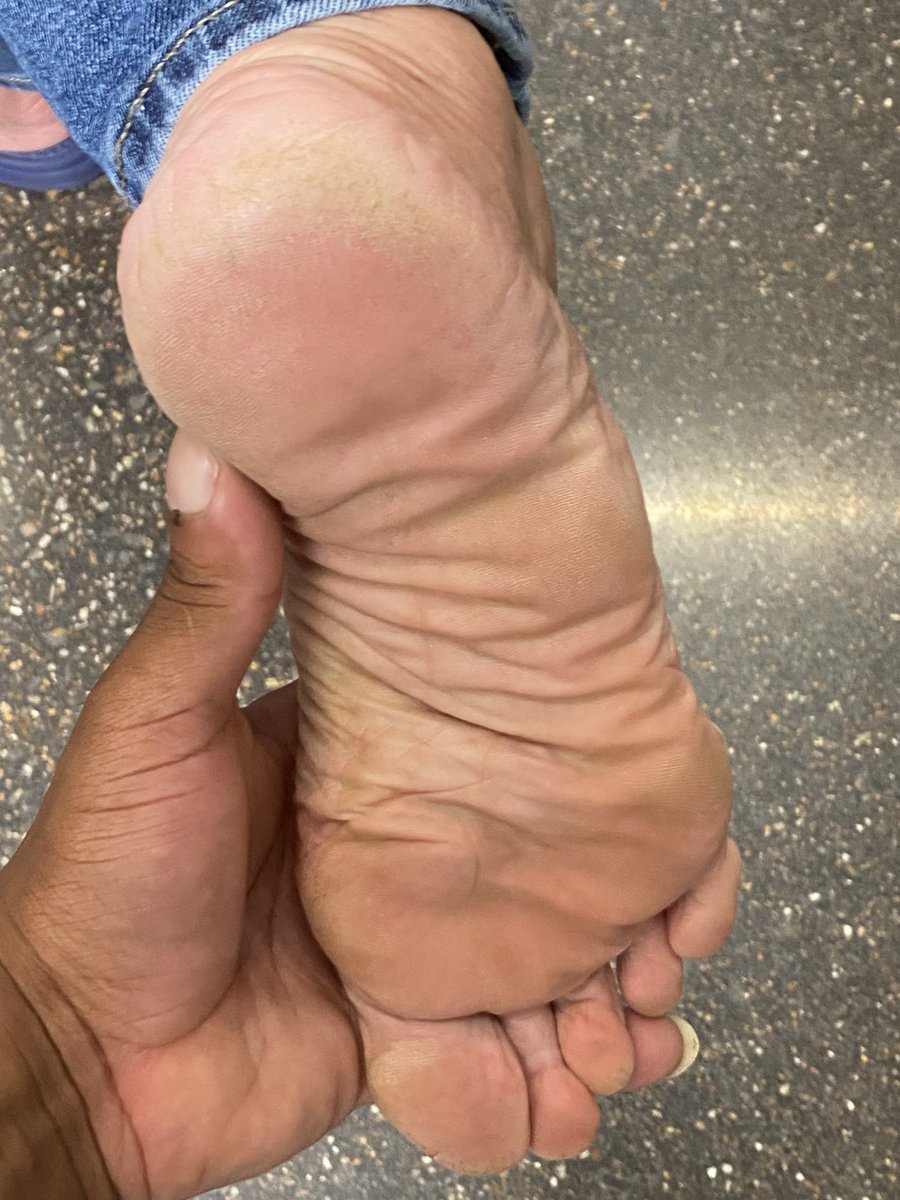 iLikeMilfFeet's tweet photo. White #MILF #feet Size 11 https://t.co/CQTX1Ouw8w