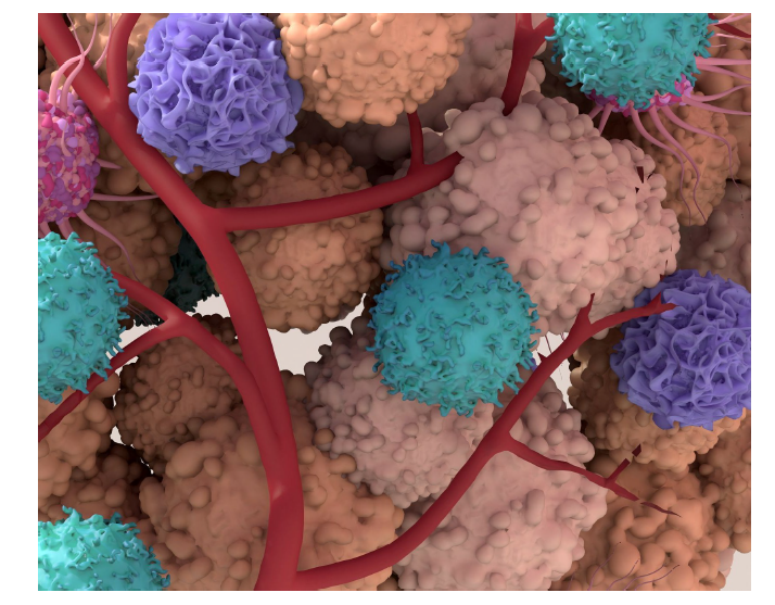 NancyZh60672287's tweet photo. Tumors don’t evolve alone.
📣 New @GenomeBiology  Collection on the Tumor Microenvironment: single-cell, spatial &amp; multi-omic studies of how the TME shapes tumor evolution and therapy response.
Guest eds: @IamLinghua @kchenken &amp; me
🗓️ until 19 May 2027
 https://t.co/f7AytYygUp https://t.co/ShPeCIDlI0