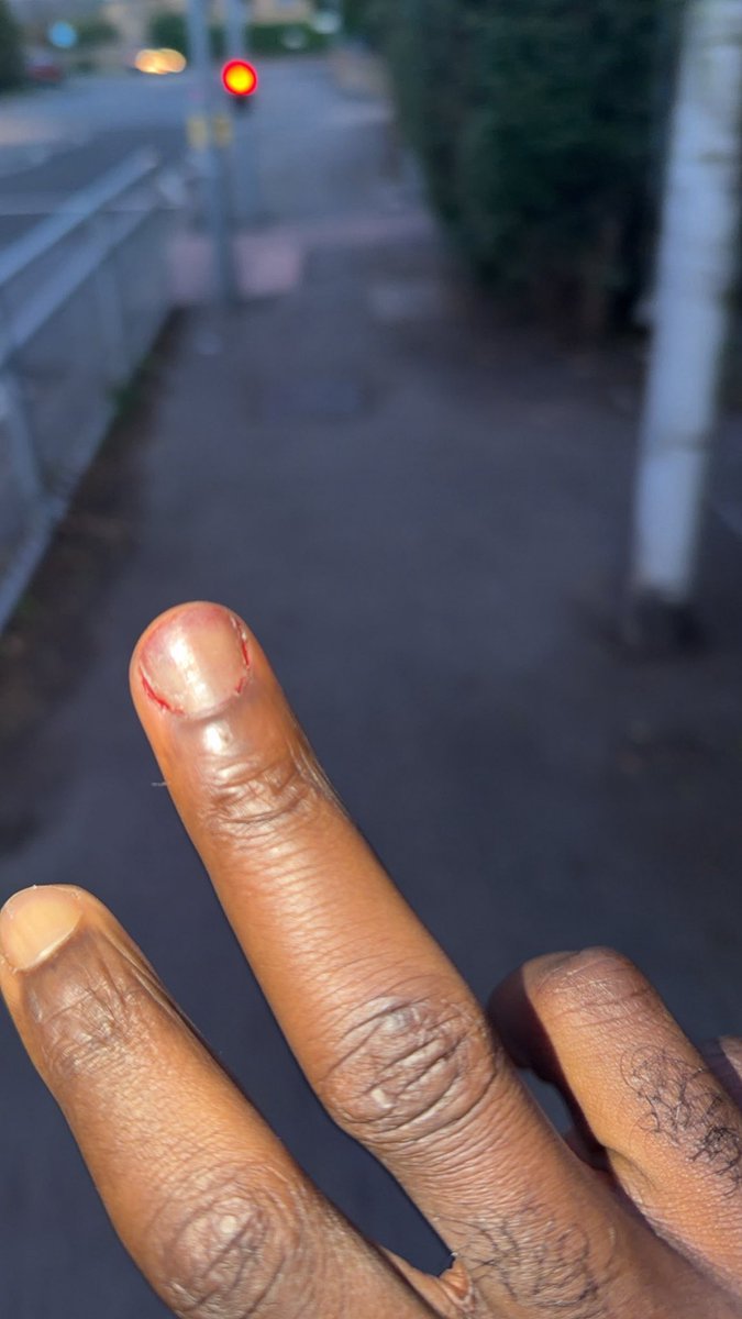 majorrnla's tweet photo. First gym incident. I guess that one coming off 🌚 https://t.co/0xu0Lr5A5G