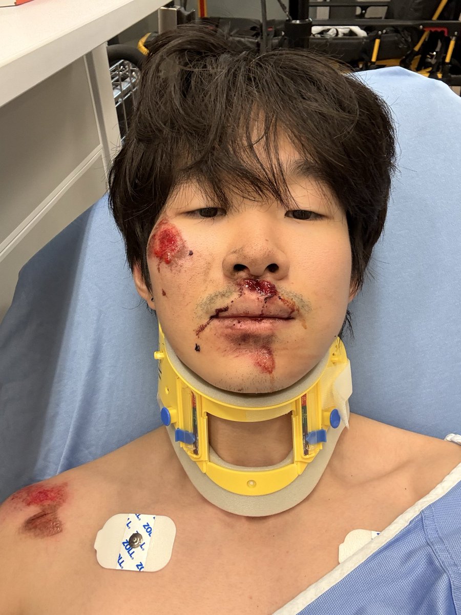 RiddlesMK's tweet photo. Got into a pretty bad bike accident so sorry if i dont stream. Stay safe out there yall https://t.co/tLXIRycyzY