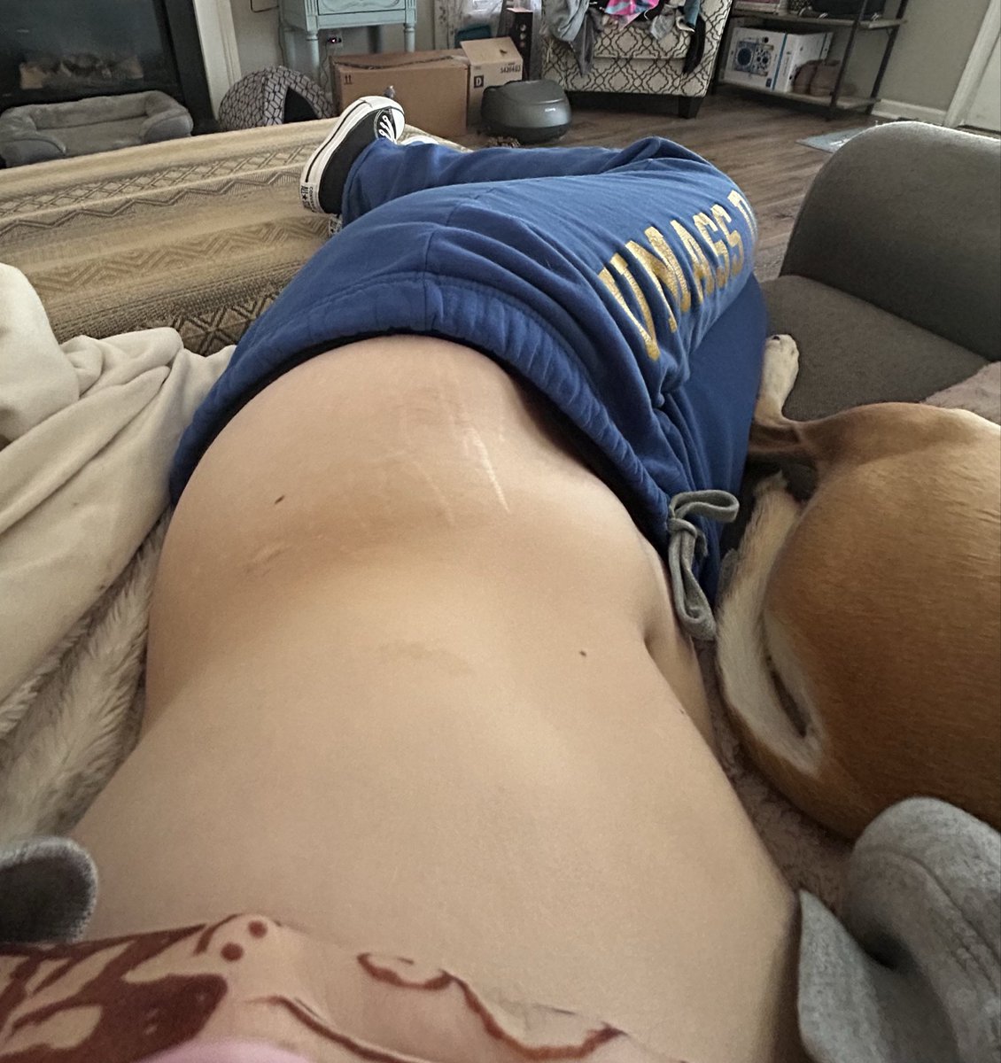 ST4RZST4RV3Z's tweet photo. Ughhhh
#edrtwt #shedrtwt #bc #bmi23 https://t.co/PMI47llLRu