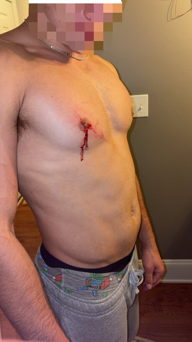 MikeDejohnn's tweet photo. Bird bit my nipple #fuck https://t.co/gOVTLfnIhh