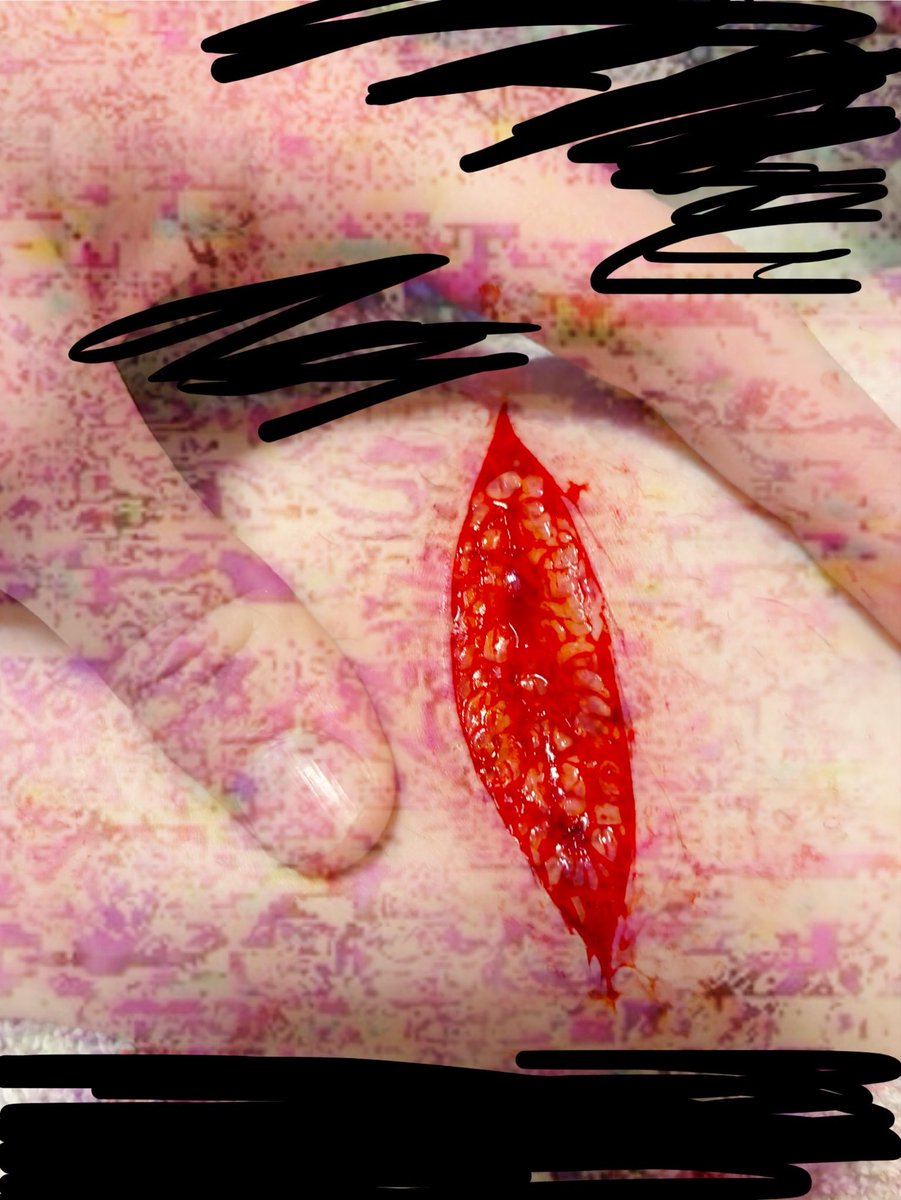xvcxxpol's tweet photo. Old sfx makeup, almost exactly a year ago https://t.co/S3gOxpMsYk