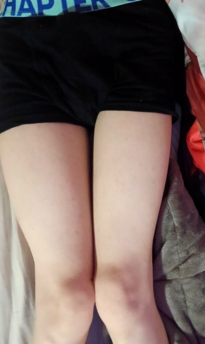 FemboyHase's tweet photo. new pics,,

#femboy #twink #gay #tummy https://t.co/PclZgacW0Z