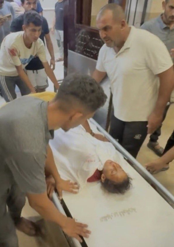 DropSiteNews's tweet photo. 🚨Eight-year-old Palestinian child Amal al-Mughair was killed when Israeli forces fired three missiles at tents sheltering displaced Palestinians in Al-Mawasi, Khan Younis, according to Ahmed Al-Najjar, Press TV correspondent in Gaza. 

14 other Palestinians, including other children, were wounded. Video filmed by Nasser Qeshta at Nasser Medical Complex shows Amal’s relatives gathered around her body as injured children receive treatment nearby.