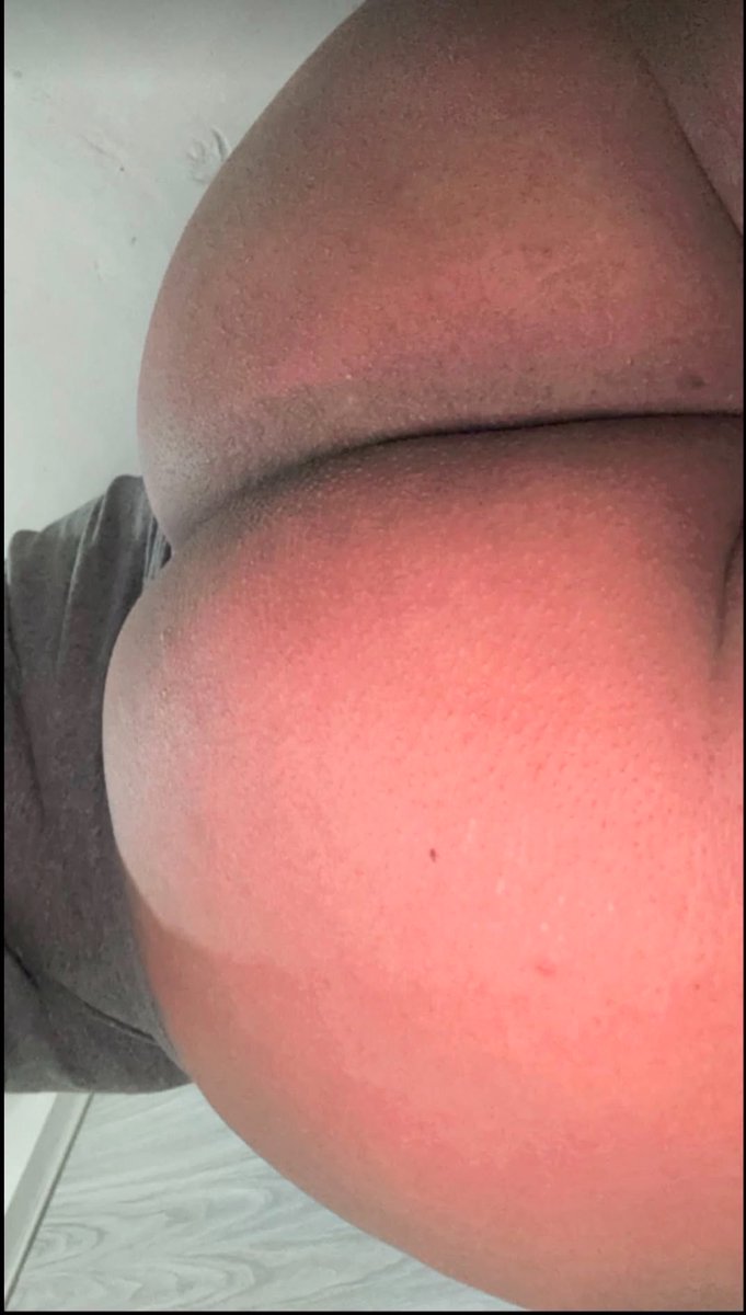 guxelqlon's tweet photo. Avrrrr esos likes🫣🫣🔥 

RT y t mando regalito🙈🍑 

@ReGio_LanDiaM https://t.co/vkOSRHJUhU