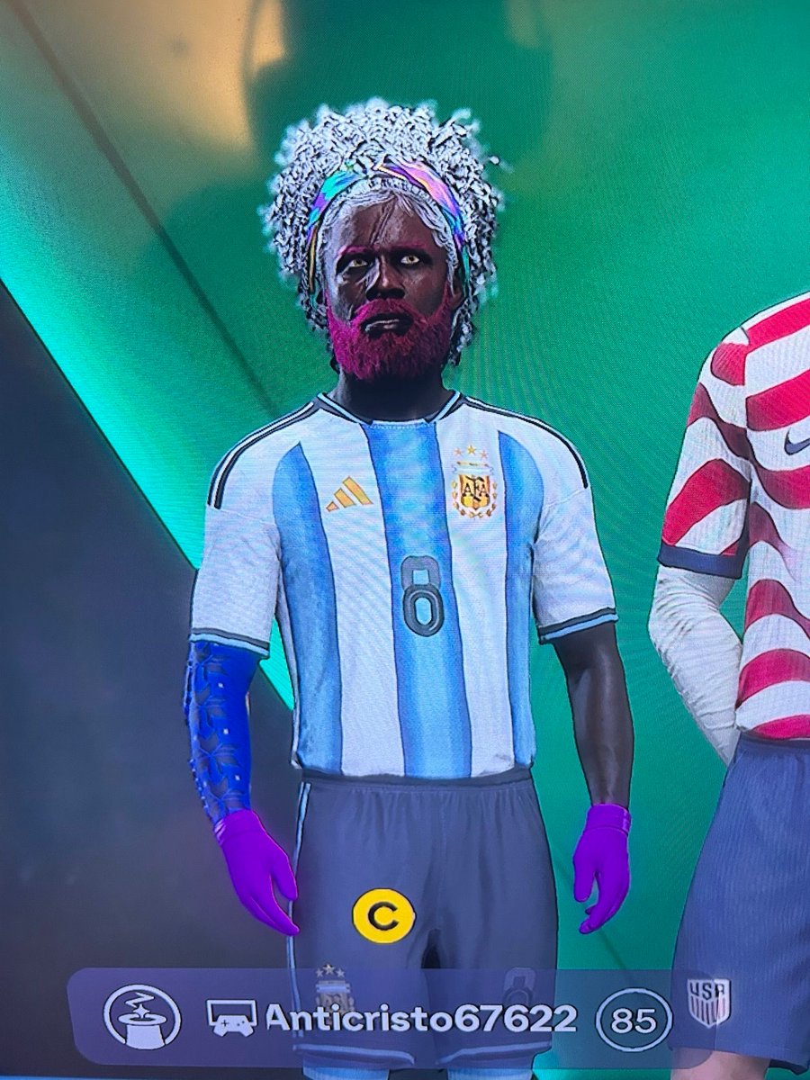 FacesOfFIFA11's tweet photo. This is embarrassing. 

#EAFC
#FIFA
#EAFCCLUBS
#PLAYSTATION
#XBOX https://t.co/CQf0KXt86L