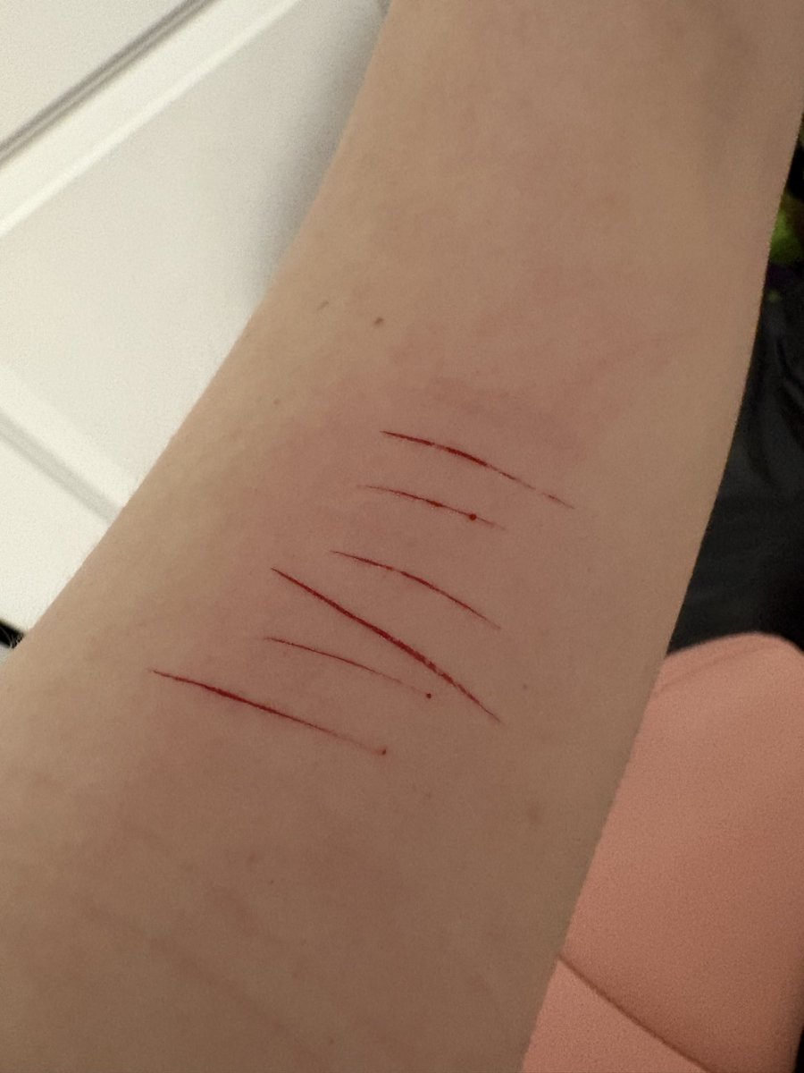 calicallann's tweet photo. cuts — why does leg cutting hurt worse than arm cutting 😵‍💫 https://t.co/Q8axV9g0qJ