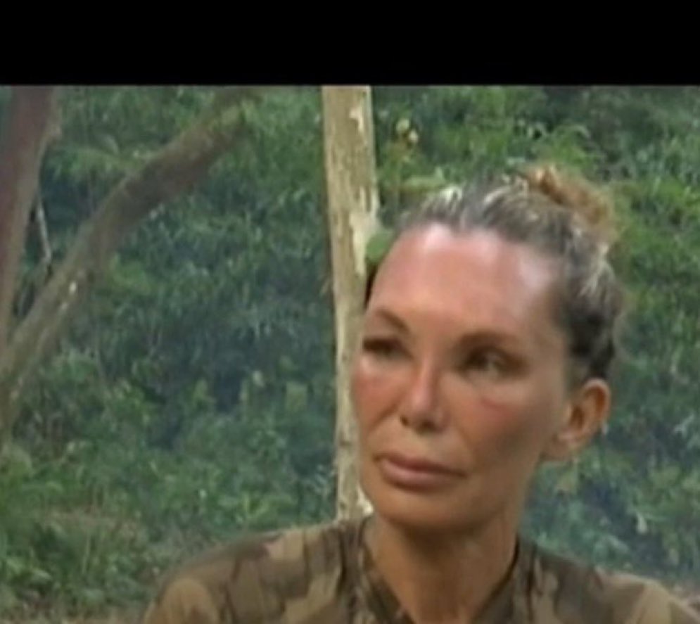 sugarcriminal's tweet photo. que mona yola haciendo cosplay de adara con el botox y los picotazos de los mosquitos https://t.co/OO49VRHw1p