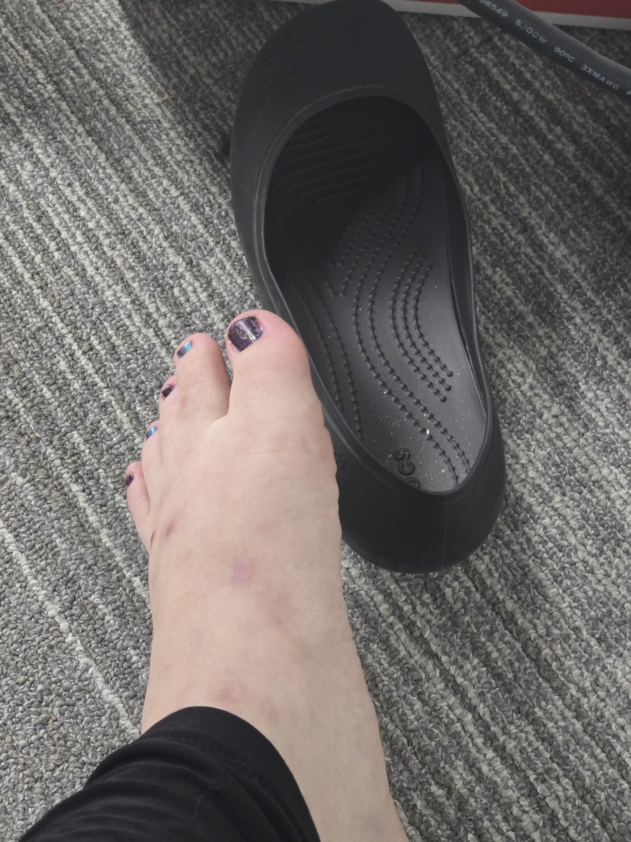 HyperFreakYou's tweet photo. Socks or No socks... Im curious. #footfetısh #feetworshi̇p #stinkysocks https://t.co/xSd9rmssje