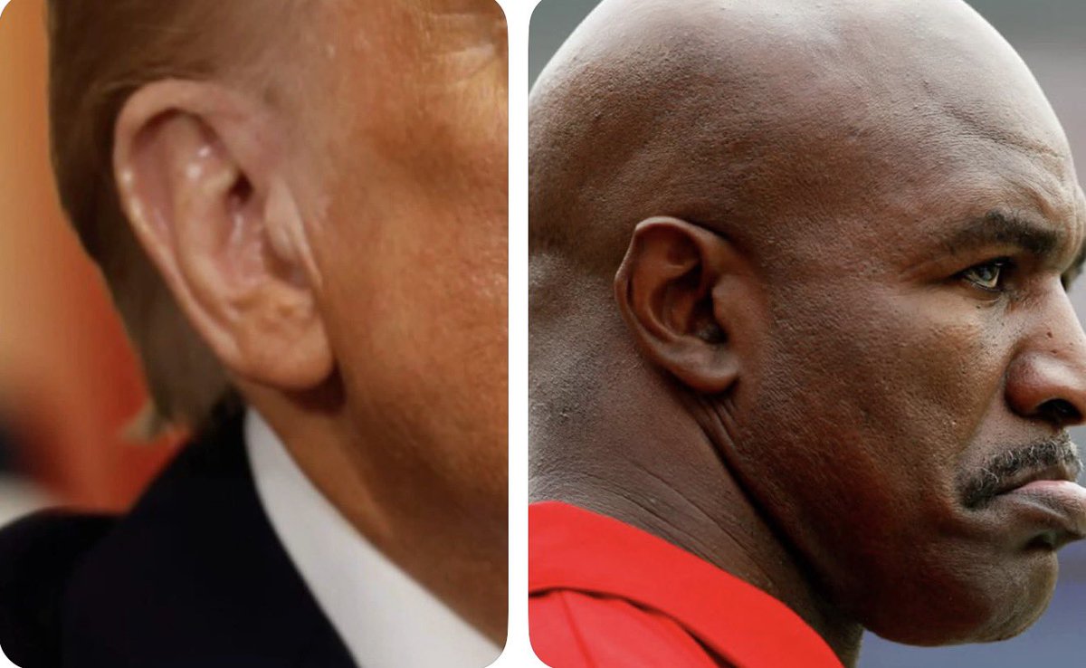 SpencerHakimian's tweet photo. Donald Trump’s ear 1 month after being hit with a round from an AR-15 vs Evander Holyfield’s ear 30 years after being bitten https://t.co/Hn5kSfvmDR