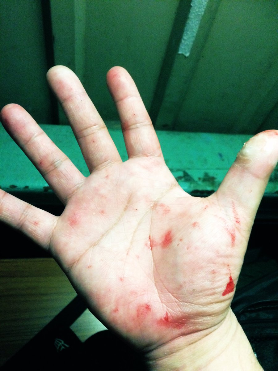 bjw_nacs's tweet photo. 【画鋲という悪夢📌】
💀レフェリーは膝、手とまず
サポーターをしないと貫通する

💀手に穴があく

💀靴に画鋲が付いて滑りやすい

💀元警察官のとあるレスラーが誤飲した

💀画鋲344440個デスマッチの際、
鎧になるぐらいの装備でレフェリングをした

それぐらい画鋲は危険⚠️
#bjw1000 #bjw https://t.co/wA2QnJIGqY