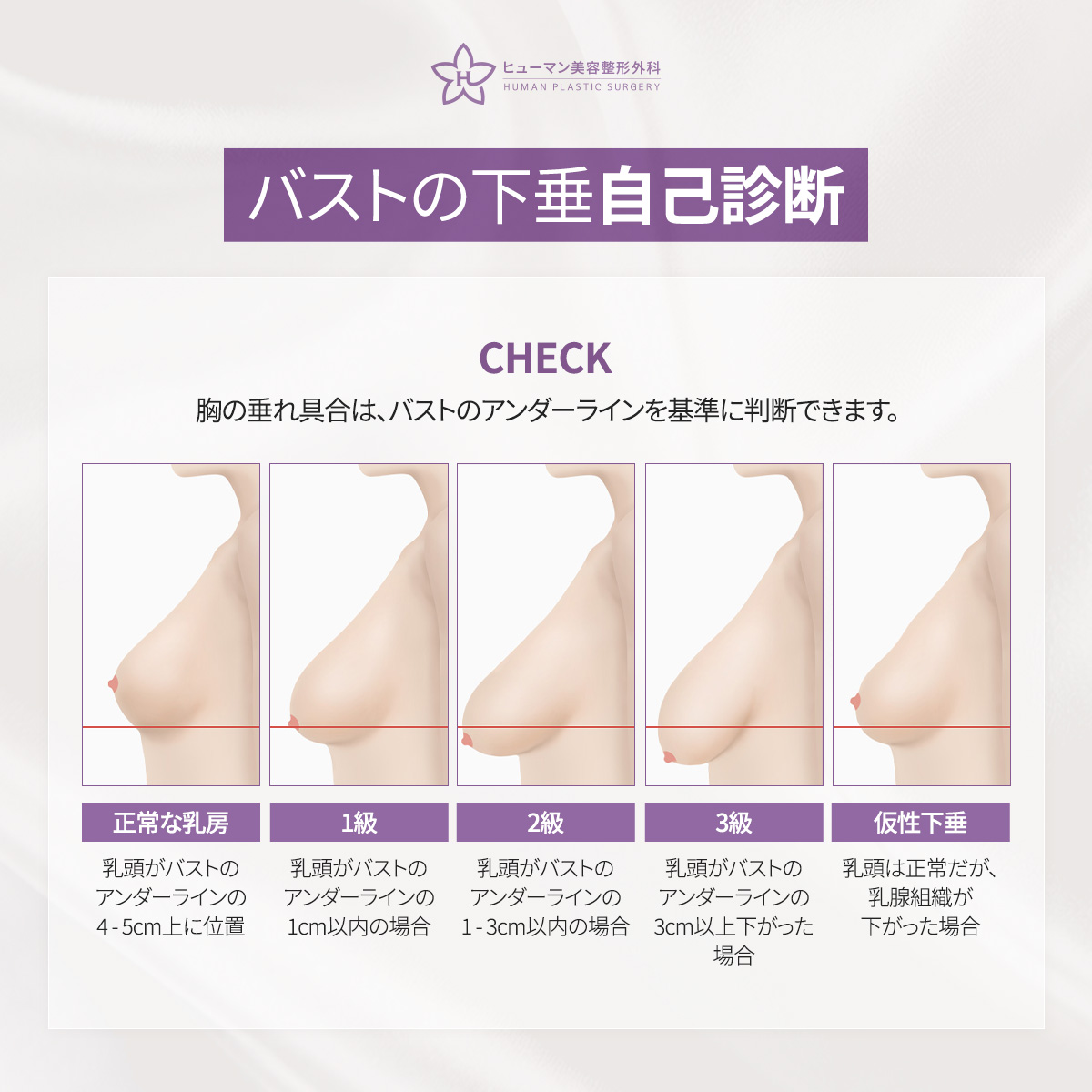 humanpsjp's tweet photo. ヒューマンの
「乳房吊り上げ術（バストリフト）」🩷

✔ バストの下垂が気になる
✔ ハリがなくなった
✔ 上胸部のボリュームが減った

詳しくは▶ アメーバブログ📖
https://t.co/6HerKdAxXZ

💜ご相談・ご予約💜
LINE ID：humansjp

#豊胸 #豊胸専門医 #ヒューマン美容外科 https://t.co/9gy4C73Fsf