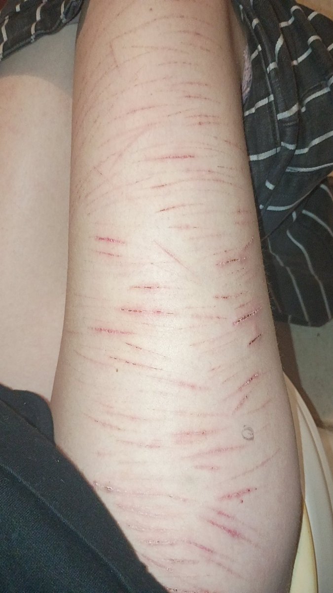 ChiTheChobit's tweet photo. Is this thinspo??
Also the makeup I did a week and a half ago, I forgot to wash it off >~<

#sharm #shedrtwt #thinspo #edrtwtㅤ #edtwt https://t.co/62yPNIbXT4