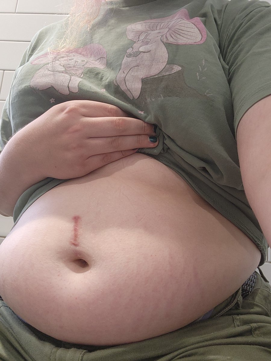 LadyLowki's tweet photo. TGirl Tummy Tuesday :333
#TGirl #TransFeedee #Feedee #Feedism #Chubby https://t.co/rtsLccmzaO