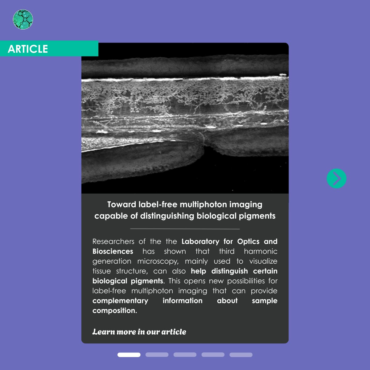 Fr_BioImaging's tweet photo. 📢 The France-BioImaging September newsletter is out!

Updates from our nodes, recent events, training opportunities, job offers... everything you need to know about France-BioImaging is inside.

How to read it? Click here ⤵️
https://t.co/SSHujIG1zP https://t.co/W0w2XOy0Ub