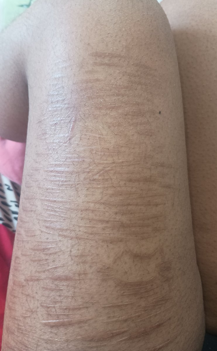 __suacidal's tweet photo. fake body ai generated sfx makeup scar check :ppp https://t.co/TctM9IqFLP
