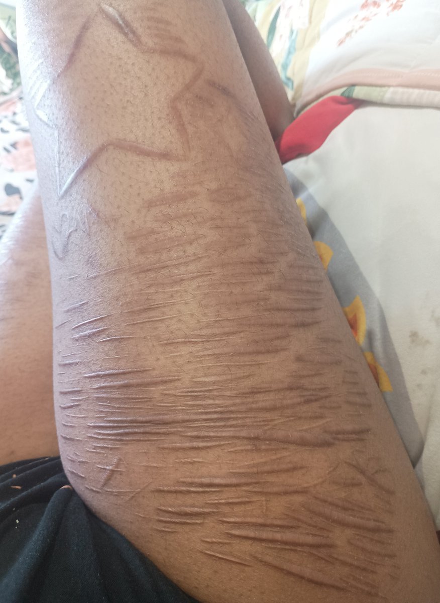 __suacidal's tweet photo. fake body ai generated sfx makeup scar check :ppp https://t.co/TctM9IqFLP