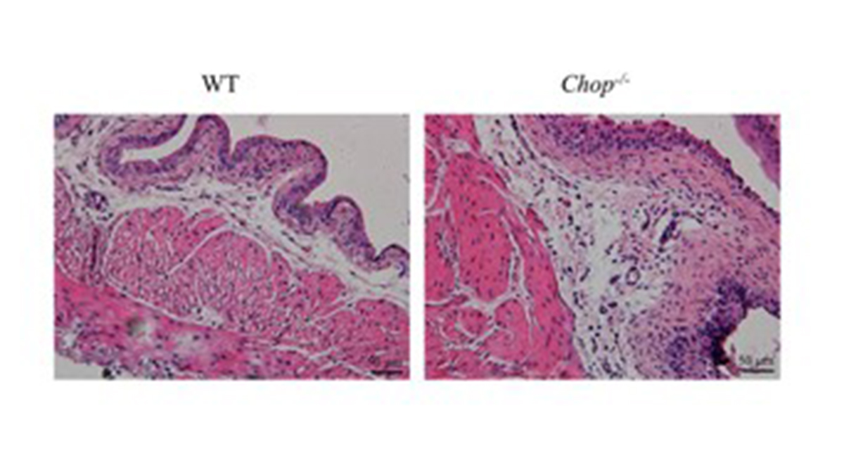 cmedicalscience's tweet photo. This study demonstrates that CHOP deficiency intensifies inflammation, epithelial apoptosis, and injury by suppressing ER stress, pointing to CHOP as a therapeutic axis.
Read: https://t.co/1vTA74NxbK
#currentmedicalscience #Urology #CHOP #ERStress #Apoptosis https://t.co/Pqs65Aw6HR