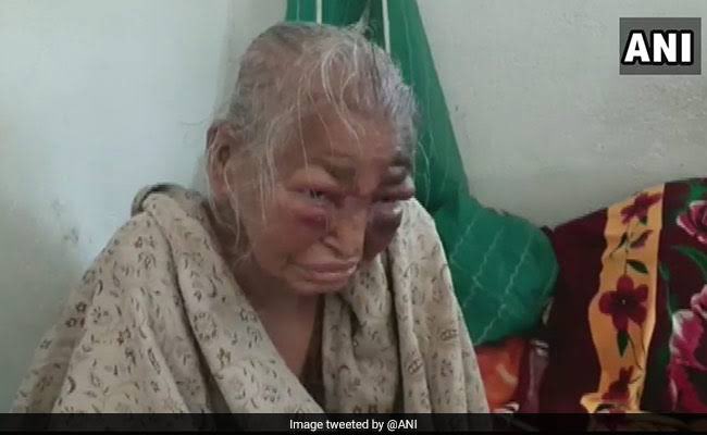 LalaXd's tweet photo. Abhishek Banerjee posted a story crying over a minor injury.

But when an elderly woman was assaulted by TMC workers and later died, where was this concern?

Karma is a glitch. https://t.co/4ckoXHTflv