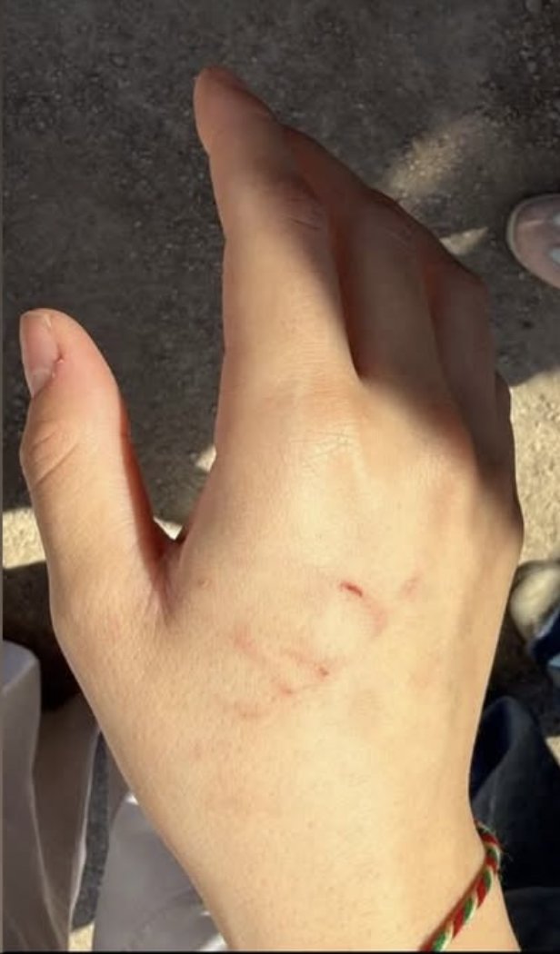 cd_snn13's tweet photo. Ez nijadperêstên ereb mesûl nabînim.. ew ê xwe dikin.. 

ez ji vê rewşê, feraseta dijminhez berpirs digrim. 

Ji destpêka şoreşê ve me digo zimanê dayikê, wan digo îtîraf bi ziman naye kirin, 

me digot ji bo vîna azad divê şexsîyê xwendekar derkeve pêş, wan digo bê lêdan û ceza em nikarin xwendekar terbiye bikin, 

me digo zarokên xwe bişînin dibistana zimanê dayikê wan digo em pêşeroja zarokên xwe li cem rejîmê dibînin.. 

ji erebên nijadperêst û cihadîst zêdetir kurmê di nava me de zirarê didin ziman û çanda dayikê..

#Rojava #Kurd #ZimanêDayikê