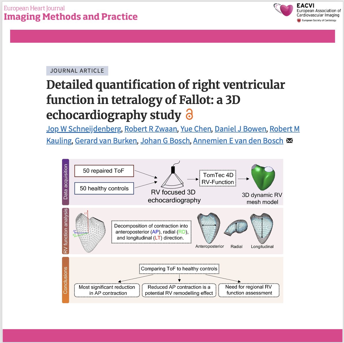 EHJIMPEiC's tweet photo. 🫀 Are we missing the most important component of right ventricular dysfunction in repaired Tetralogy of Fallot?
A novel 3D echocardiography approach provides a more detailed assessment of right ventricular (RV) mechanics by separating RV contraction into longitudinal, radial, and anteroposterior (AP) components—revealing previously unrecognized patterns of RV remodelling in patients with repaired Tetralogy of Fallot (ToF).
🔍 Key findings:
✅ Anteroposterior (AP) contraction was the main contributor to RV dysfunction, showing the greatest reduction in ToF patients compared with healthy controls.
✅ Despite overall RV impairment, the relative contribution of longitudinal contraction increased, suggesting a compensatory mechanism rather than uniform deterioration of RV function.
✅ The anterior free wall mirrored the global remodelling pattern, highlighting regional heterogeneity and the importance of moving beyond conventional global RV indices.
✅ This novel software enables automated directional decomposition of RV ejection fraction, offering a more comprehensive assessment of RV mechanics that could improve future risk stratification in congenital heart disease.
💡 By looking beyond conventional measures such as TAPSE or global RVEF, 3D echocardiography may provide new insights into right ventricular remodelling and help identify earlier markers of disease progression in adults with repaired Tetralogy of Fallot.
📖 Read the full article: https://t.co/LuRRozAIRR
#CardioX #TetralogyOfFallot #CongenitalHeartDisease #Echocardiography #3DE #RightVentricle #CardiacImaging #ACHD #Cardiology #MedTwitter #OpenScience