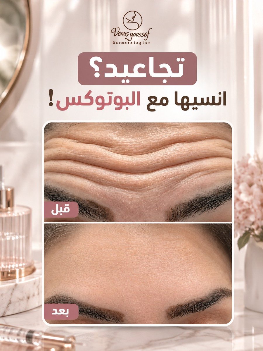VenusYoussef's tweet photo. تجاعيد؟
انسيها مع البوتوكس!
#تجاعيد_الوجه 
#بوتوكس 
#جمالك_سيدتي 
#اكسبلور https://t.co/Oaf7E5rrIS