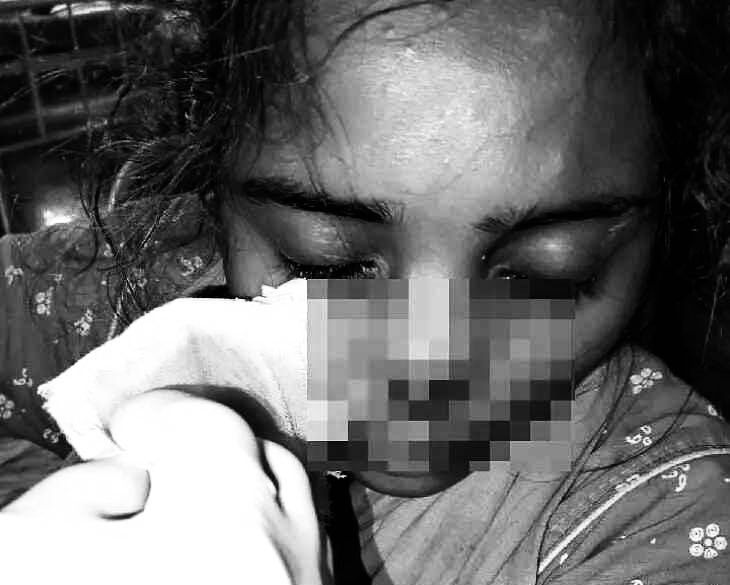 Bavazir_network's tweet photo. Husband Allegedly #Bites Off Part of Wife’s #Nose During Quarrel in #Mancherial
In a shocking incident reported from #Kotapalli Mandal headquarters in Mancherial district, a man allegedly bit his wife’s nose during a quarrel, causing a portion of her nose to be severed.
The injured woman, identified as Mamatha, was rushed to #MGMHospital in #Warangal for treatment following the incident.
According to police, Mamatha had married Mani Chandra of Mallampet nine years ago, and the couple has two daughters. Her family members allege that Mani Chandra had been harassing her for additional dowry for the past four years and frequently quarrelled with her while allegedly under the influence of alcohol.
Following a recent dispute, Mamatha reportedly returned to her parents’ home along with her two daughters.
Police said that Mani Chandra, accompanied by his family members, went to his in-laws’ house and allegedly attempted to attack Mamatha’s father, Narayana.
When Mamatha intervened to protect her father, Mani Chandra allegedly bit her nose forcefully. The attack resulted in the upper portion of her nose being severed, leaving her seriously injured.
The Kotapalli Police have registered a case and launched an investigation. SI Rajasekhar is conducting the probe.
Further details regarding the case and the sections invoked are awaited.