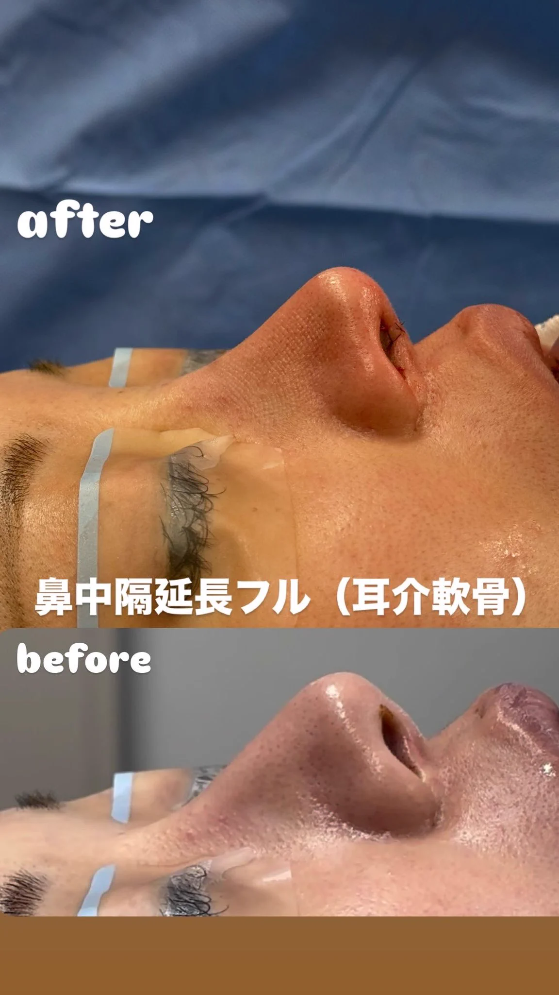 堀大輔 / 「睡眠時間は自由」睡眠改善プログラム、Nature sleep代表 on