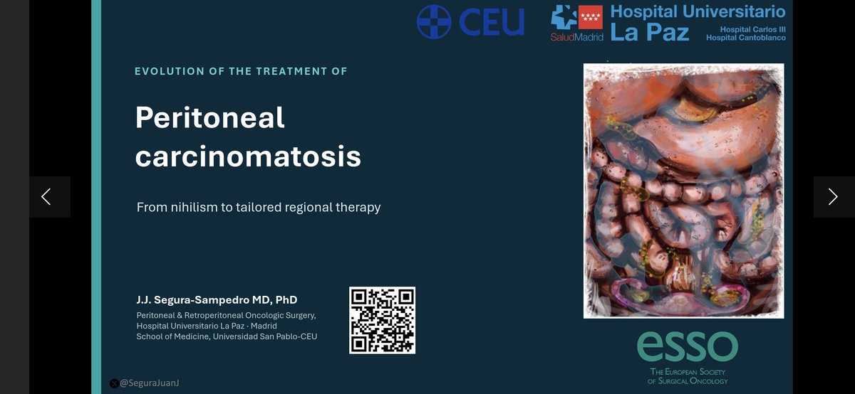 SeguraJuanJ's tweet photo. Yesterday I joined the faculty of the @ESSOweb European course on peritoneal surface malignancies, discussing the evolution of peritoneal carcinomatosis treatment.
My key message: HIPEC is not one intervention. Which treatment, for whom, when, and in which disease?
#CRS #HIPEC https://t.co/eM2tNN5wif