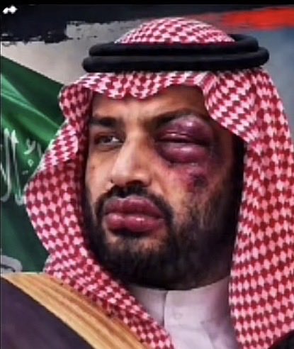 hthe12408's tweet photo. محمد بن سلمان كان له تصريح وقت بداية حرب اليمن، قال فيه إنه هيقضي على الحوثيين خلال شهرين https://t.co/6rsN0RP7lE
