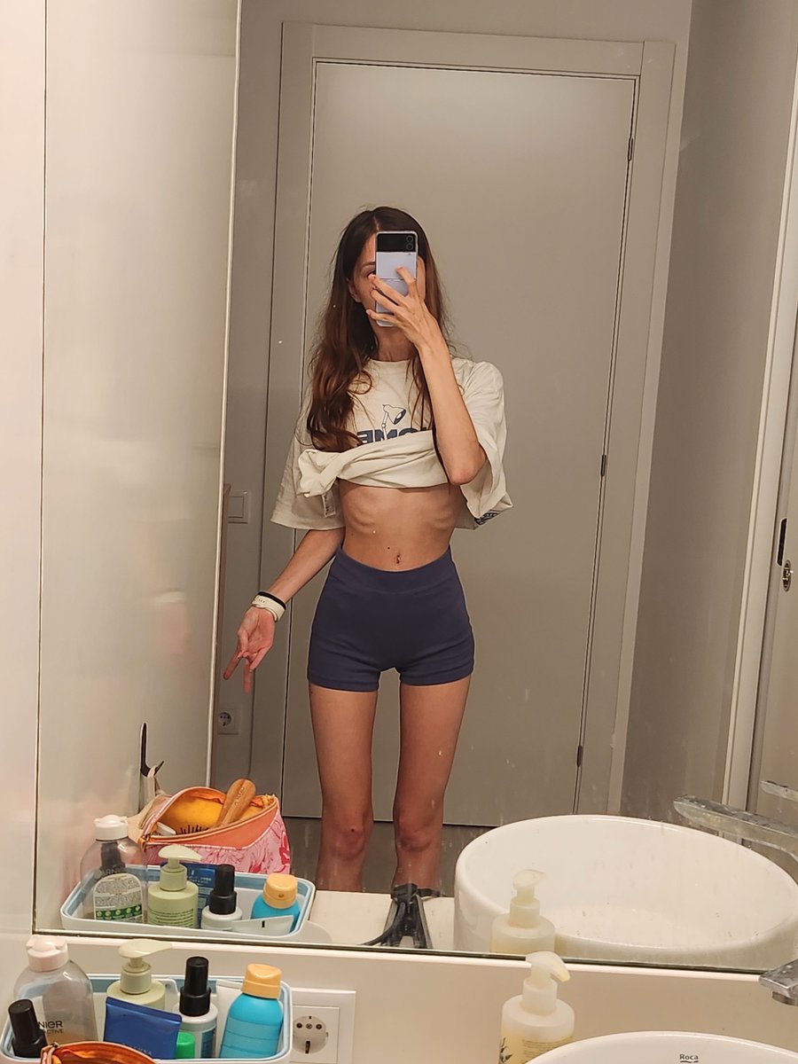 wingriddenkitty's tweet photo. the way i've managed to maintain bmi 13-14 these past 5 years needs to be studied https://t.co/vAubq9VCeI
