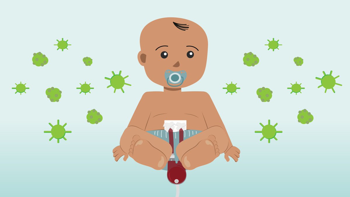 ACTION4HF's tweet photo. Approximately 1 in 3 children supported with paracorporeal VADs experienced an infectious adverse event per a recent ACTION study. The analysis found infections were associated with worse survival and identified key risk factors for infection. Read more: https://t.co/uLSu0Us7mK! https://t.co/l6Fdke4GNo