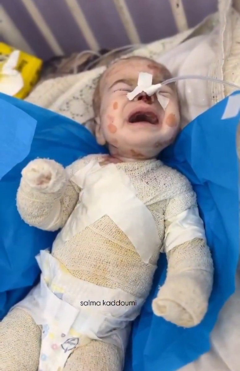 ahmadmaher_95's tweet photo. No child should ever live like this.

Gaza has been forgotten 💔 https://t.co/pFlupIcaI5
